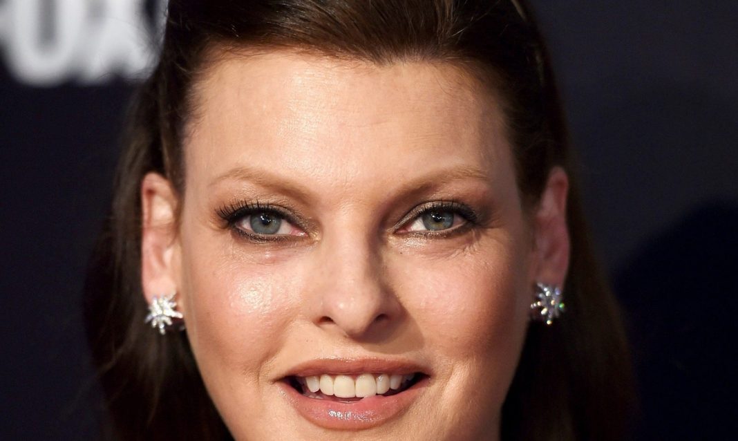 Linda Evangelista disfigured after plastic treatment

