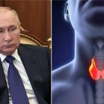  Symptoms, survival and treatment.  What do we know about the disease attributed to Putin?

