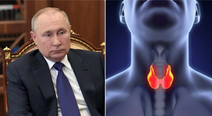  Symptoms, survival and treatment.  What do we know about the disease attributed to Putin?

