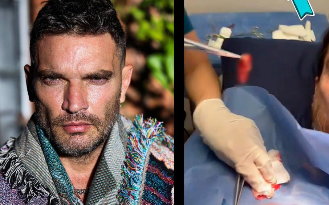 Julián Gil confiesa que fue diagnosticado con cáncer de piel 